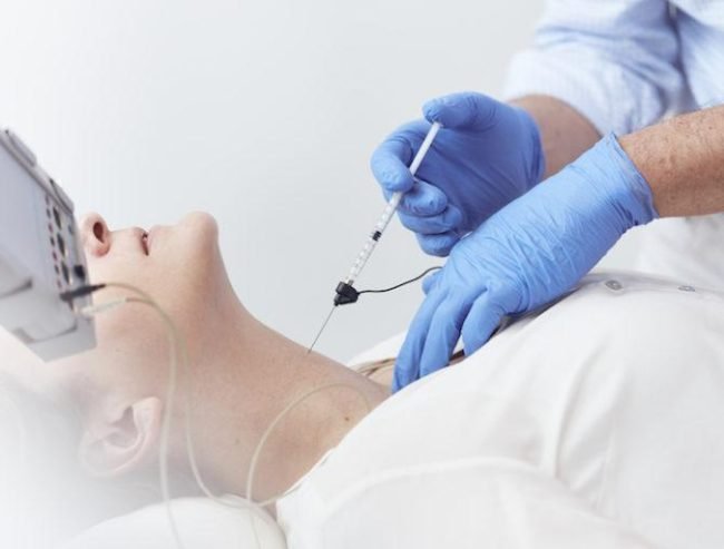 Botox Injection for Spasmodic Dysphonia