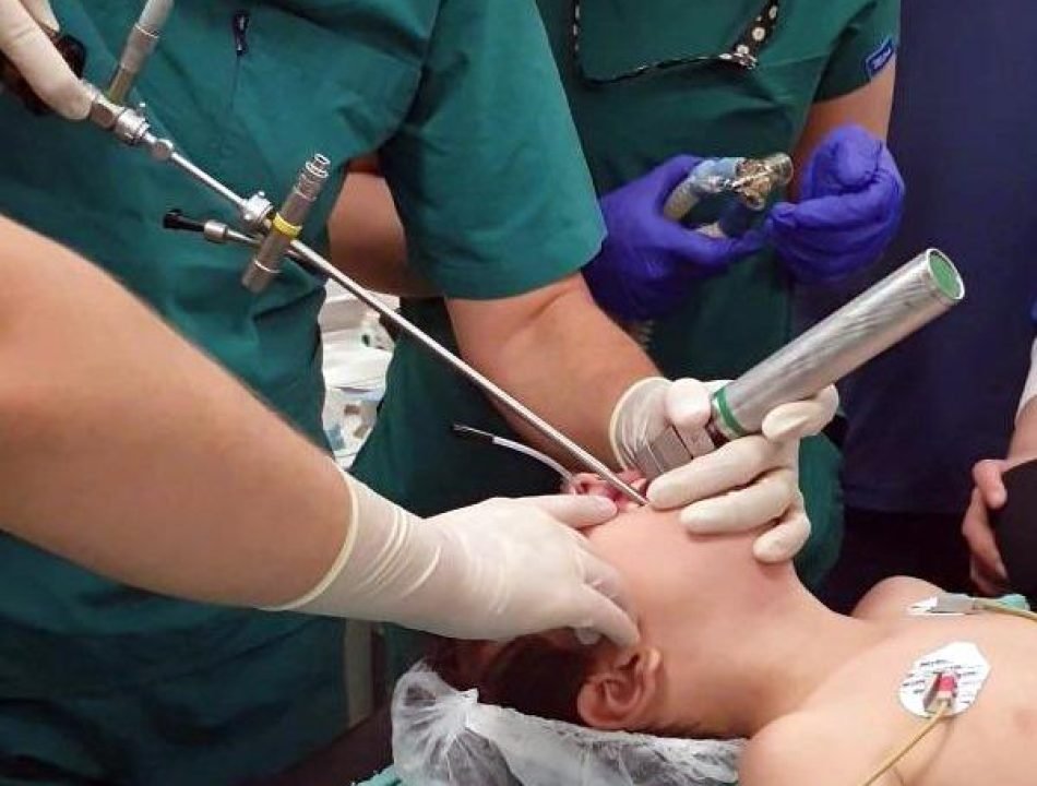 Bronchoscopy & Foreign Body Removal