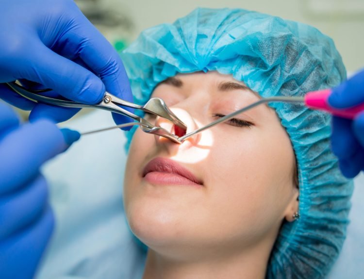 Functional-Endoscopic-Sinus-Surgery-1