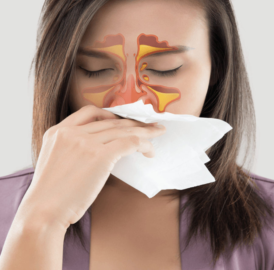 what-is-sinusitis-signs-and-symptoms-and-medical-treatment-1
